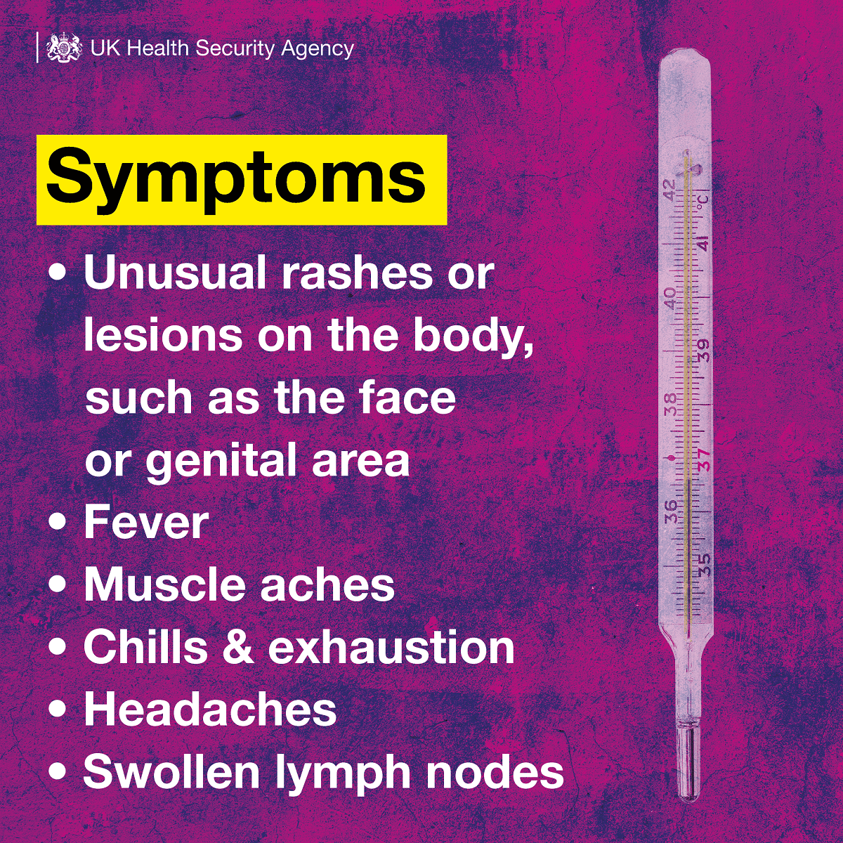 Monkeypox Information